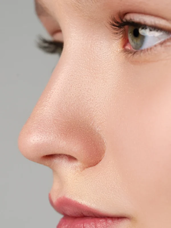 Open Rhinoplasty in 2026