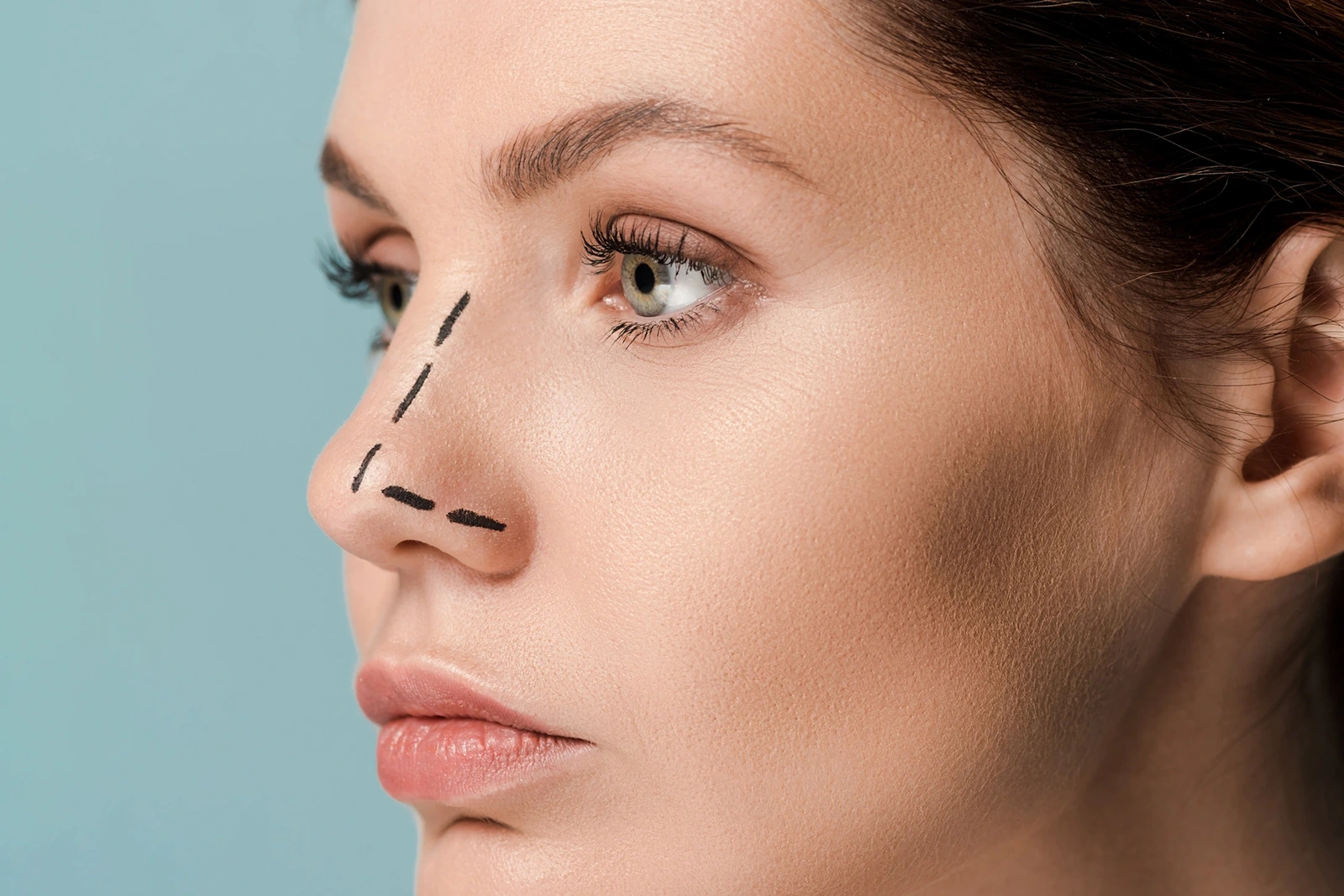 Revision Rhinoplasty in 2026